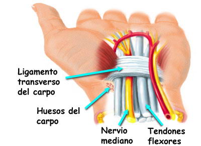 PROBLEMAS EN MANOS Y MUÑECA EN MÚSICOS. SÍNDROME DEL TÚNEL CARPIANO 